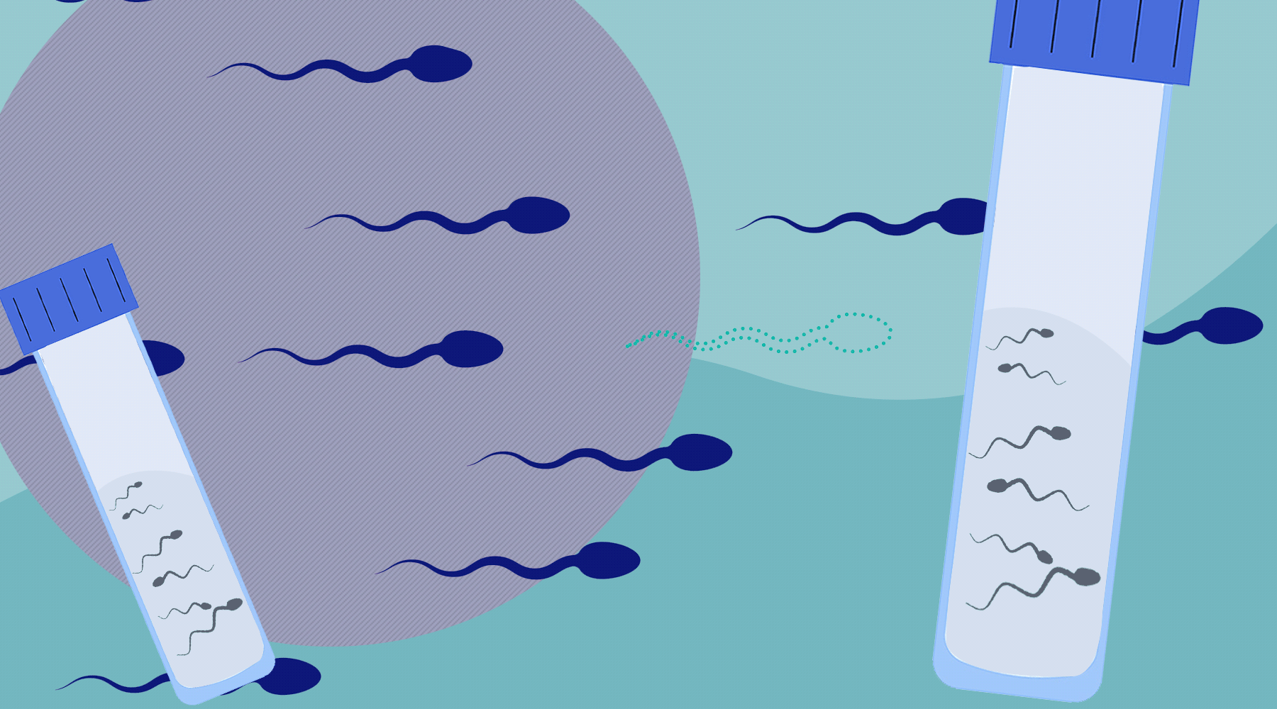 Male Infertility