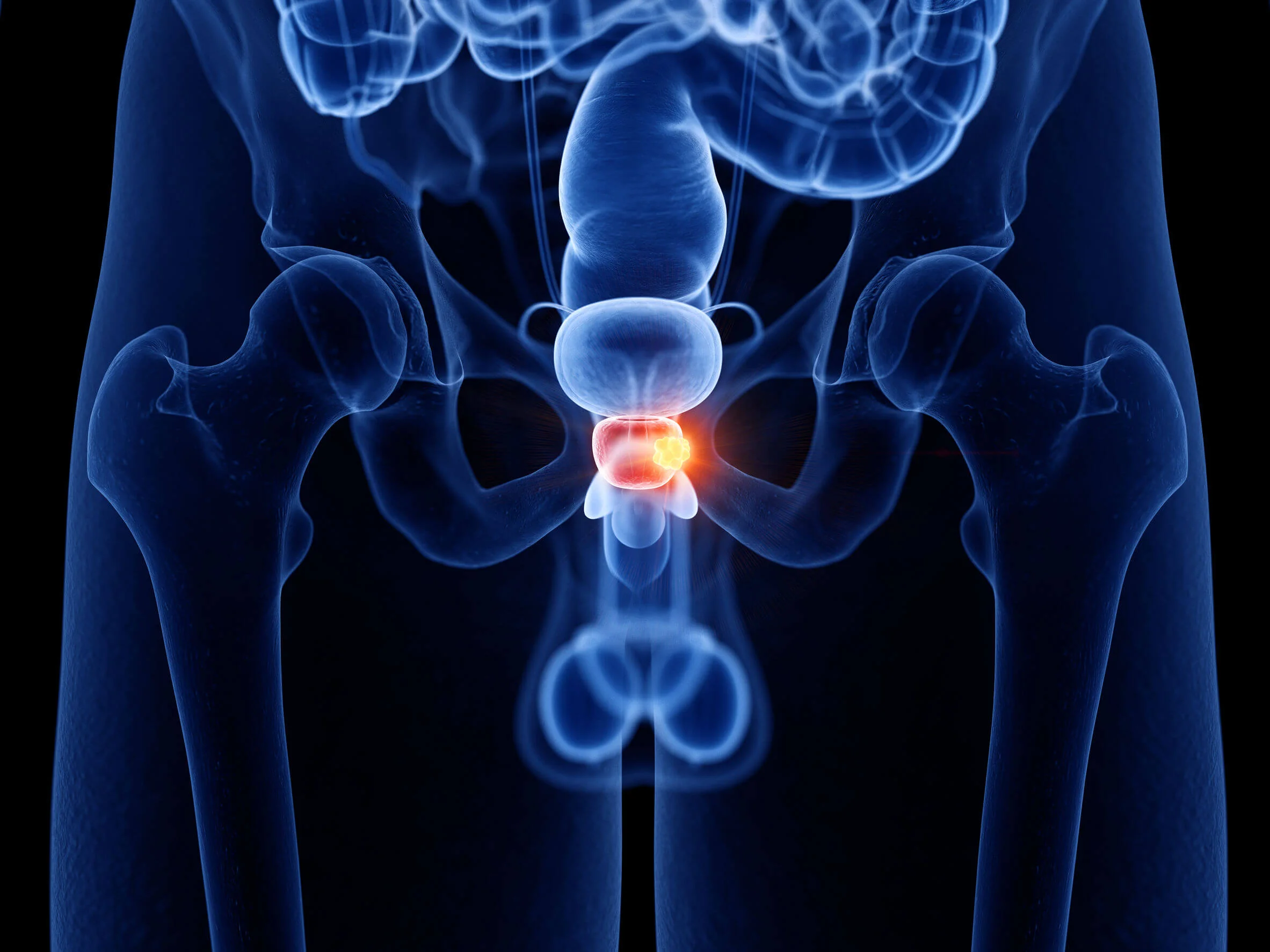 Prostate Problems